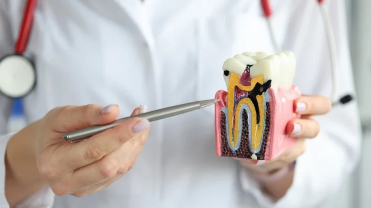 How Can I Prevent Getting a Root Canal Treatment?