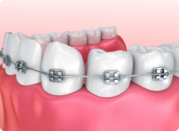 Cosmetic Dentistry