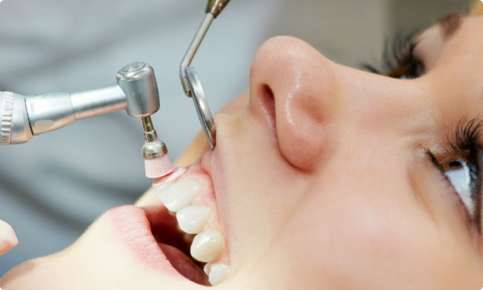 general-dental-treatment-cleaning-1